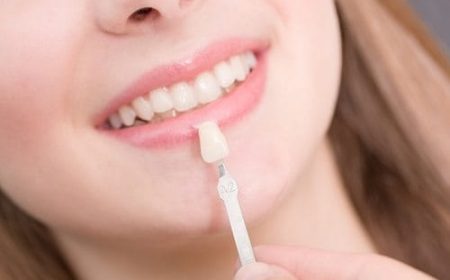 Caring-for-porcelain-veneers