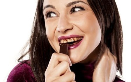 Causes-of-stained-teeth-whitening