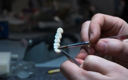 Dental-veneers-restorative-dentistry