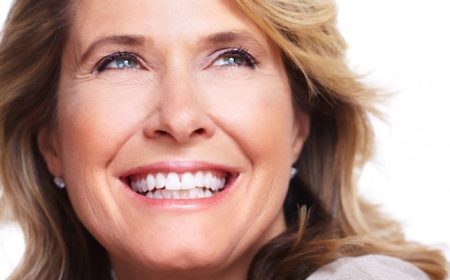 Mature-woman-with-beautiful-straight-healthy-looking-teeth-700x467-1